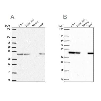 Western Blot: NDUFS2 Antibody [NBP2-30413]