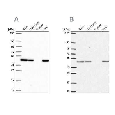 Western Blot: NDUFS2 Antibody [NBP2-49351]