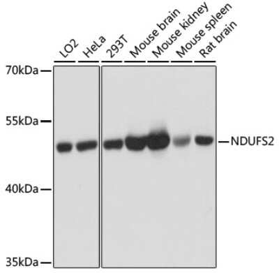 Western Blot: NDUFS2 AntibodyAzide and BSA Free [NBP3-03566]