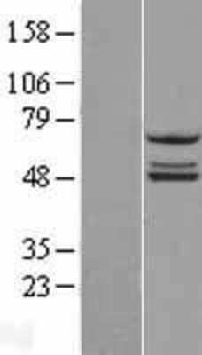 Western Blot: NDUFS2 Overexpression Lysate [NBL1-13561]