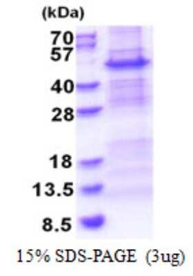 SDS-PAGE: Recombinant Human NDUFS2 His Protein [NBP2-23265]