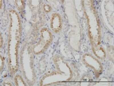 Immunohistochemistry-Paraffin: NDUFS3 Antibody (1D6) [H00004722-M02]