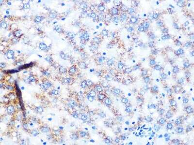 Immunohistochemistry-Paraffin: NDUFS3 Antibody (2R6F5) [NBP3-16287]