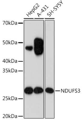 Western Blot: NDUFS3 Antibody (2R6F5) [NBP3-16287]