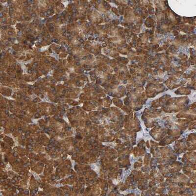 Immunohistochemistry-Paraffin: NDUFS3 Antibody [NBP1-85619]