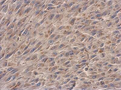 Immunohistochemistry-Paraffin: NDUFS3 Antibody [NBP2-19505]