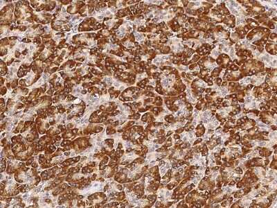 Immunohistochemistry-Paraffin: NDUFS3 Antibody [NBP2-99071]