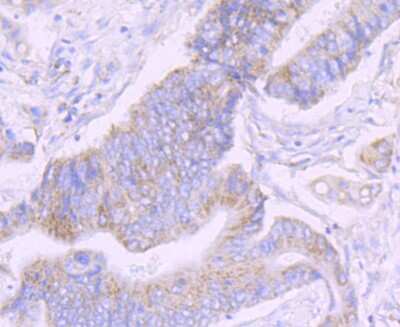 Immunohistochemistry-Paraffin: NDUFS3 Antibody (JU10-32) [NBP2-75587]