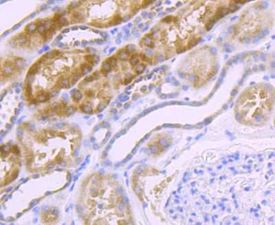 Immunohistochemistry-Paraffin: NDUFS3 Antibody (JU10-32) [NBP2-75587]