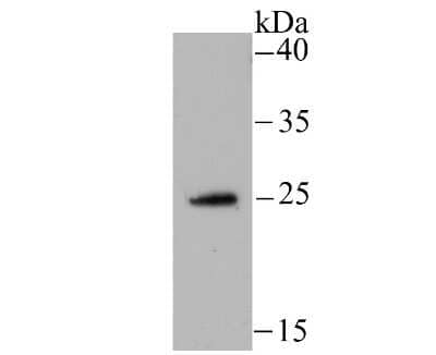 Western Blot: NDUFS3 Antibody (JU10-32) [NBP2-75587]