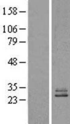 Western Blot: NDUFS3 Overexpression Lysate [NBL1-13562]