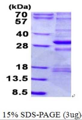 SDS-PAGE: Recombinant Human NDUFS3 His Protein [NBP2-23266]