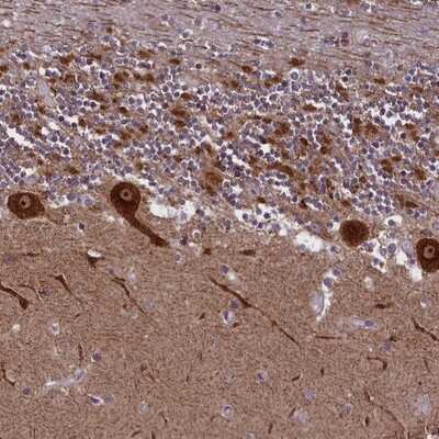 Immunohistochemistry-Paraffin: NDUFS5 Antibody [NBP2-13648]