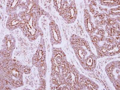 Immunohistochemistry-Paraffin: NDUFS5 Antibody [NBP2-19506]