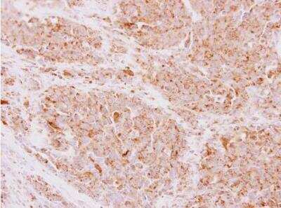 Immunohistochemistry-Paraffin: NDUFS5 Antibody [NBP2-19506]