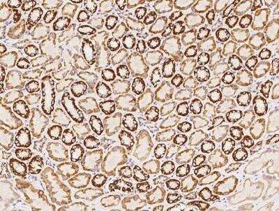 Immunohistochemistry-Paraffin: NDUFS5 Antibody [NBP3-12617]