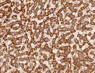 Immunohistochemistry-Paraffin: NDUFS5 Antibody [NBP3-12617]