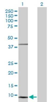 Western Blot: NDUFS5 Antibody [H00004725-D01P]
