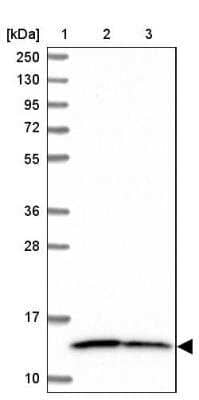 Western Blot: NDUFS5 Antibody [NBP2-13648]