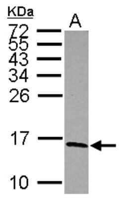 Western Blot: NDUFS5 Antibody [NBP2-19506]