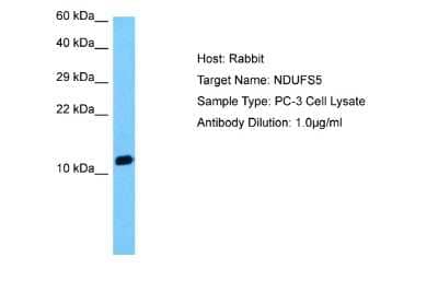 Western Blot: NDUFS5 Antibody [NBP2-87894]