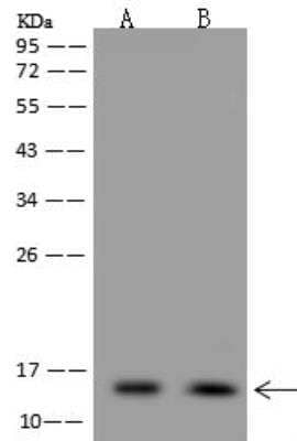 Western Blot: NDUFS5 Antibody [NBP3-12617]