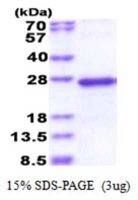 SDS-PAGE: Recombinant Human NDUFS5 His Protein [NBP2-51571]