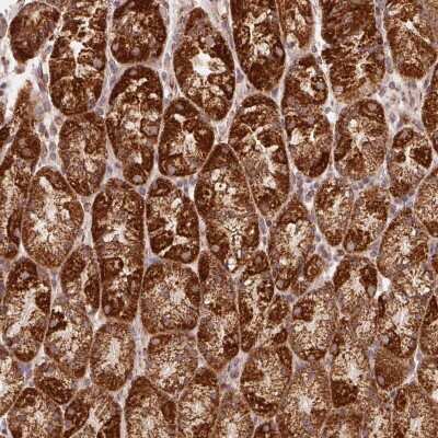 Immunohistochemistry: NDUFS6 Antibody [NBP2-39020]