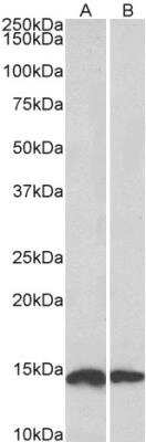 Western Blot: NDUFS6 Antibody [NBP1-49831]
