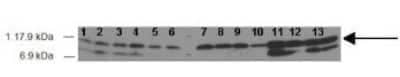 Western Blot: NDUFS6 Antibody [NBP1-98576]