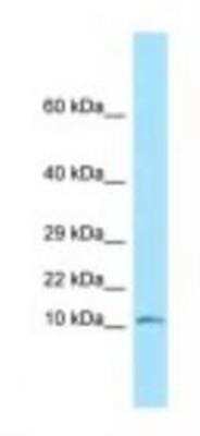 Western Blot: NDUFS6 Antibody [NBP1-98576]