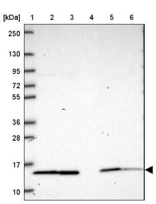 Western Blot: NDUFS6 Antibody [NBP2-39020]