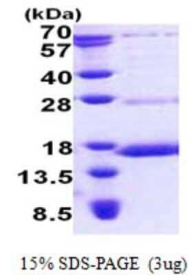 SDS-PAGE: Recombinant Human NDUFS6 His Protein [NBP2-23267]