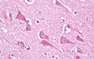 Immunohistochemistry-Paraffin: NDUFS7 Antibody [NBP1-49846]