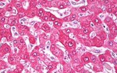 Immunohistochemistry-Paraffin: NDUFS7 Antibody [NBP1-49846]
