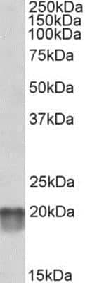 Western Blot: NDUFS7 Antibody [NBP1-49846]