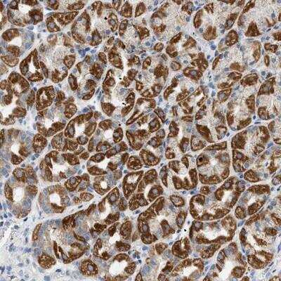 Immunohistochemistry-Paraffin: NDUFS8 Antibody [NBP1-85620]
