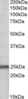 Western Blot: NDUFS8 Antibody [NBP1-49847]