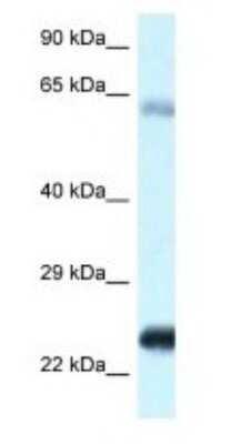 Western Blot: NDUFS8 Antibody [NBP1-79908]