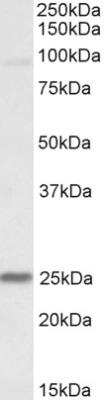 Western Blot: NDUFS8 Antibody [NBP2-26107]