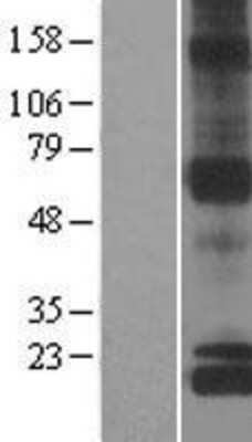 Western Blot: NDUFS8 Overexpression Lysate [NBL1-13566]