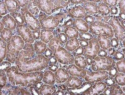 Immunohistochemistry-Paraffin: NDUFV1 Antibody [NBP1-33074]