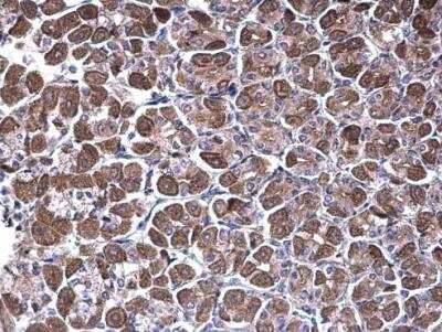 Immunohistochemistry-Paraffin: NDUFV1 Antibody [NBP1-33074]