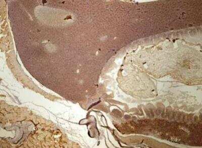 Immunohistochemistry-Paraffin: NDUFV1 Antibody [NBP1-33074]