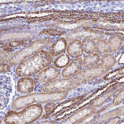 Immunohistochemistry-Paraffin: NDUFV1 Antibody [NBP1-92173]