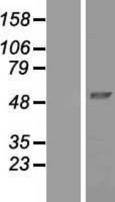 Western Blot: NDUFV1 Overexpression Lysate [NBP2-07531]