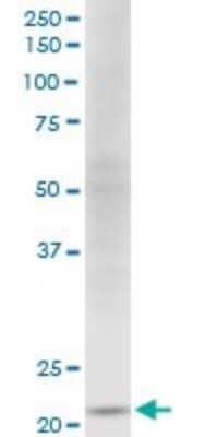 Western Blot: NDUFV2 Antibody (1A10) [H00004729-M03]
