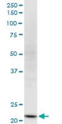 Western Blot: NDUFV2 Antibody (1A10) [H00004729-M03]