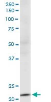 Western Blot: NDUFV2 Antibody (1A10) [H00004729-M03]