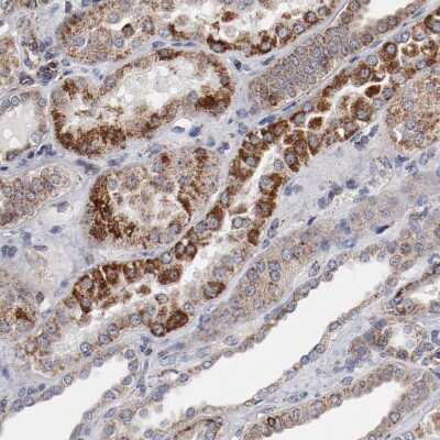Immunohistochemistry-Paraffin: NDUFV2 Antibody [NBP1-84475]